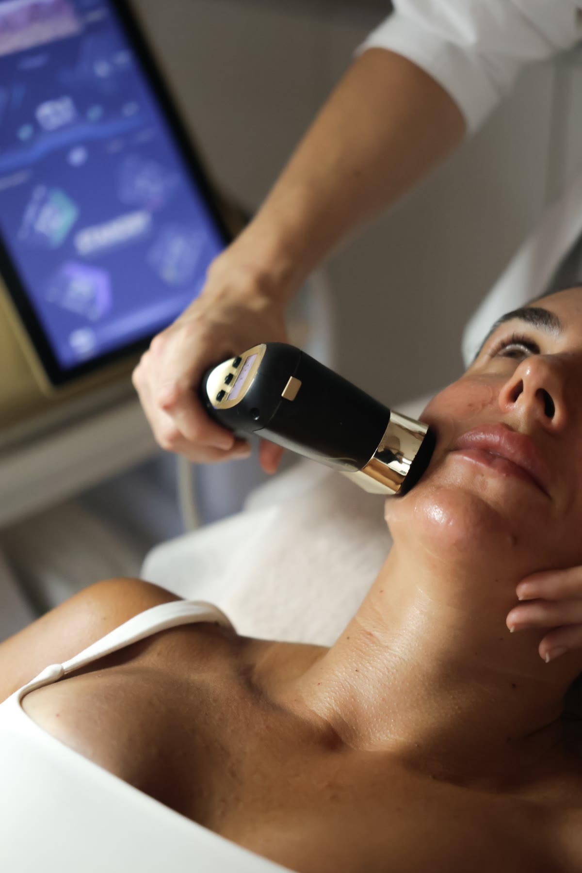 Tratamento facial na ÓG